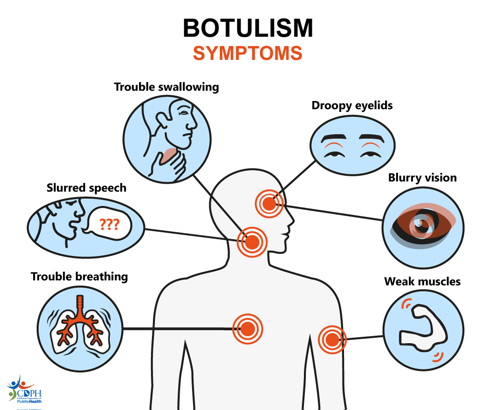 Botulism symptoms include trouble swallowing, droopy eyelids, blurry vision, slurred speech, weak muscles, and trouble breathing Botulism symptoms include trouble swallowing, droopy eyelids, blurry vision, slurred speech, weak muscles, and trouble breathing