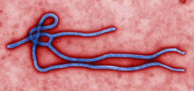 Ebola virus under microscope