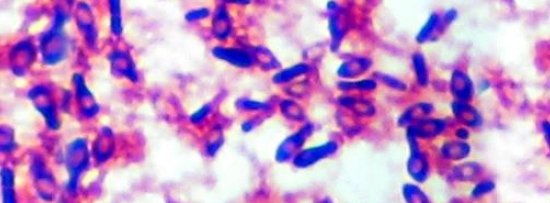 Gram Stain Clostridiumbotulinum Gram Stain Clostridiumbotulinum