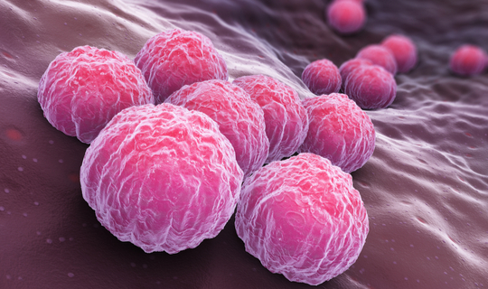 Chlamydia